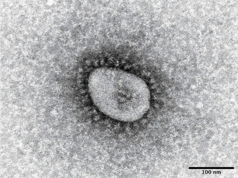 -over-covid-19-newly-infected-people-10000-reached-nationwide-1642061459-1.jpeg