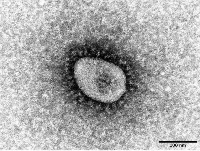 newly-infected-people-in-japan-exceed-30000-for-the-first-time-1642572380-1.jpeg