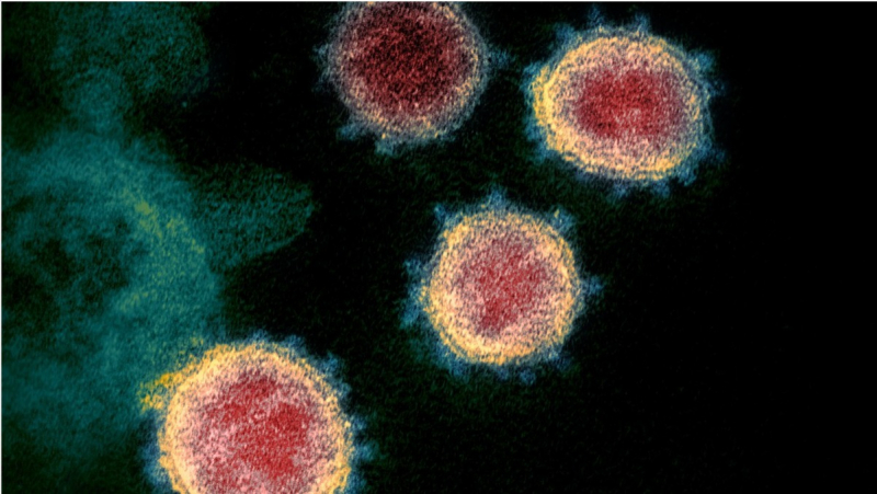 breaking--news---17631-new-infected-people-in-tokyo-the-highest-number-ever-1643609405-1.jpeg