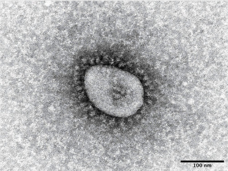 -126576-new-coronavirus-infections-in-japan--1659076736-1.jpeg