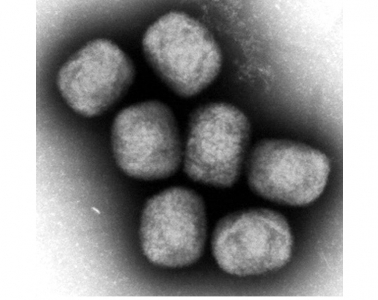 new-monkeypox-infection-confirmed-in-tokyo-from-overseas-traveler-1659494654-1.jpeg