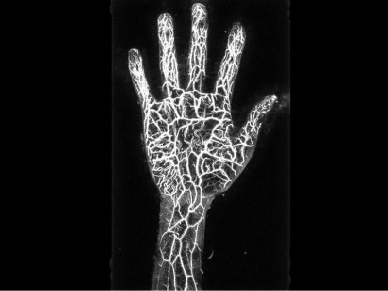 -a-diagnostic-device-that-can-take-3d-images-without-exposure--developed-by-luxonas-1631501203-1.png